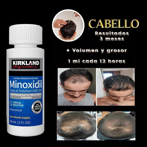 🚫 Basta de excusas, basta de caída 💧 MINOXIDIL™ 5% & 6% — Tú mereces verte bien"