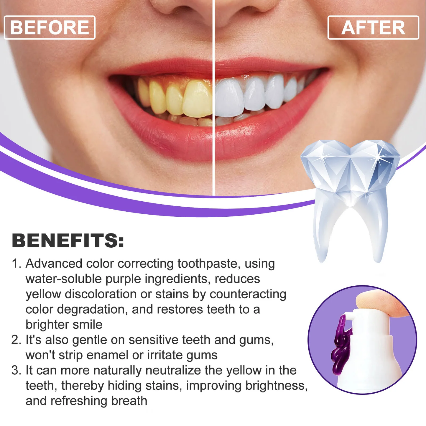 💭 ¿Te afligen tus dientes manchados a causa del café, té o vino? Soluciónalos ya!  con el  Blanqueador Dental™ 😁✨