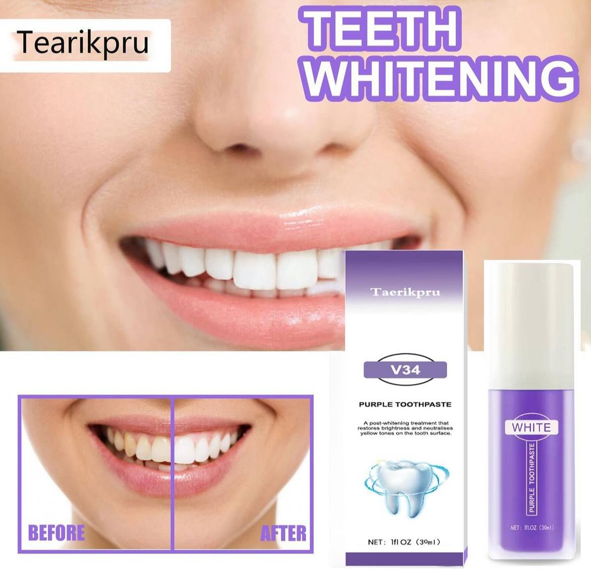 💭 ¿Te afligen tus dientes manchados a causa del café, té o vino? Soluciónalos ya!  con el  Blanqueador Dental™ 😁✨